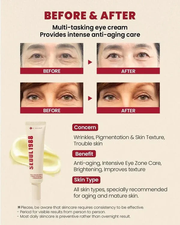 SEOUL 1988 Eye Cream Retinal Liposome 4% + Fermented Bean 30ml