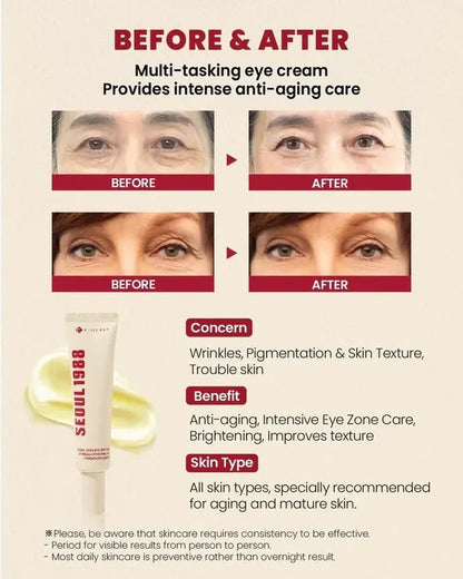 SEOUL 1988 Eye Cream Retinal Liposome 4% + Fermented Bean 30ml